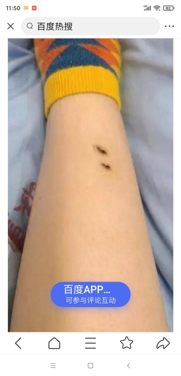 7777788888四肖四码管家婆和女子遭毒蛇咬伤身亡与女子遭毒蛇咬伤身亡视频