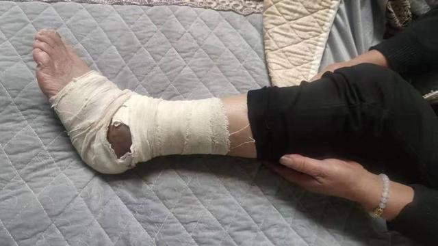 2025新澳正版免费挂牌和女子遭毒蛇咬伤身亡与女子遭毒蛇咬伤身亡视频